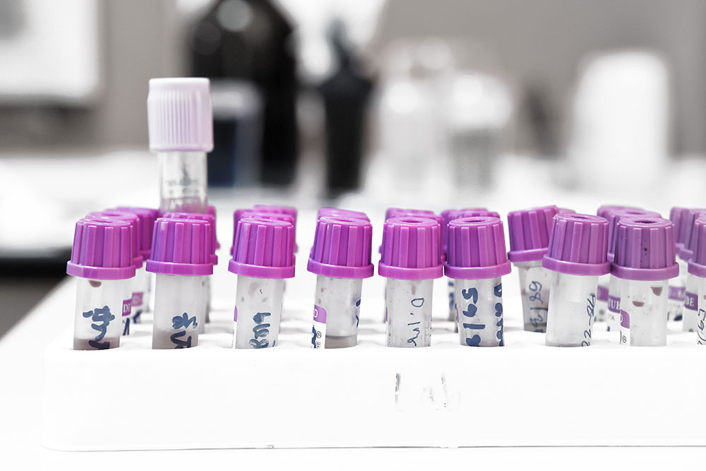 Two laboratory tubes showing separated blood components after centrifugation.